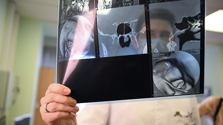 Российские ученые разработали платформу для борьбы с опухолью мозга