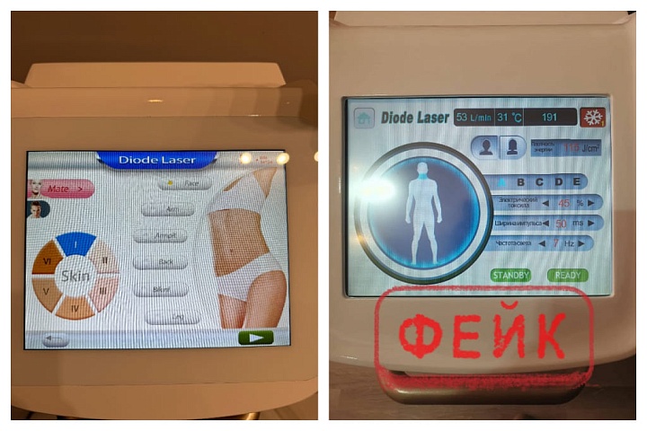 Евгений Майер, создатель аппаратов лазерной эпиляции, сообщил о проблеме появления дешёвых подделок